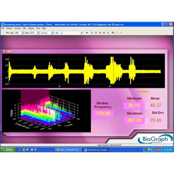 MYOTRAC INFINITI – biofeedback