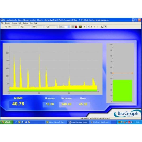 MYOTRAC INFINITI – biofeedback