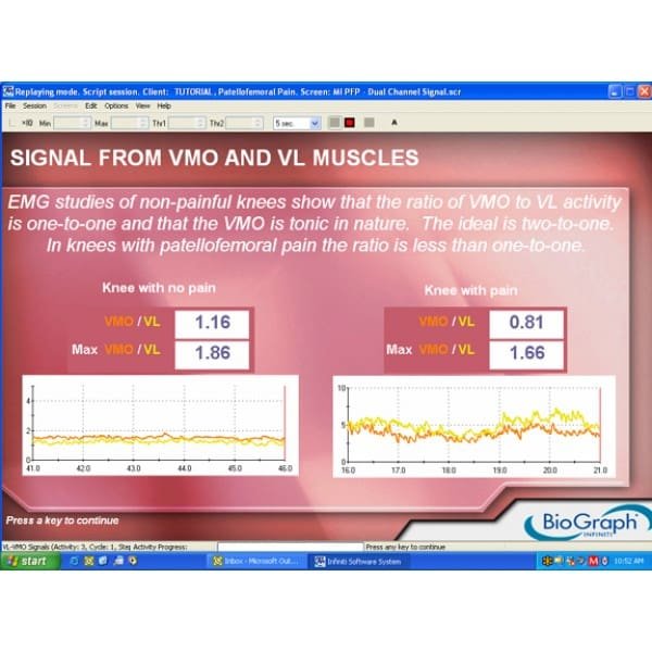 MYOTRAC INFINITI – biofeedback